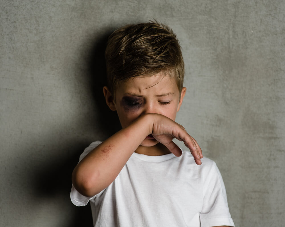 Boy crying with black eye from abused.